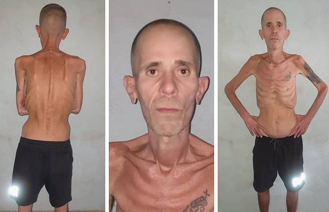 Cuba, il corpo torturato che smentisce il regime